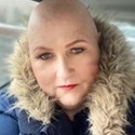 Jo is wearing a coat with a furry collar. She has no hair after having cancer treatment.